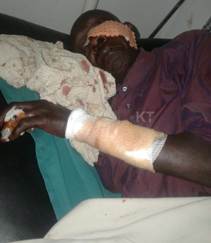 Uyu musaza w'imyaka 70 nawe arimo kwitabwaho n'abaganga nyuma yo kuzahazwa n'imbwa