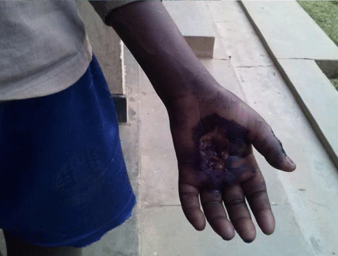 Yacanye buji ayimujojobereza mu kiganza.