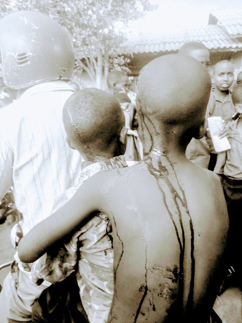 Hifashishijwe umumotari mu kujyana abana bakomeretse kwa muganga