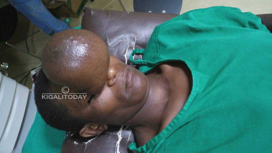 Uko yari ameze mbere y'uko abagwa