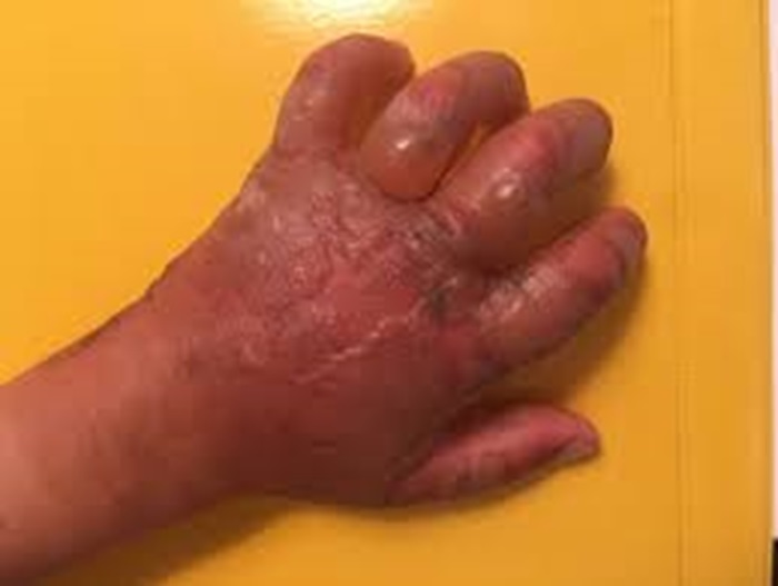 Amazi afasha uwahiye kutangizwa cyane n