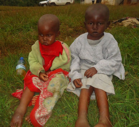 Aba bana batahutse tariki 19/01/2013 bigaragara ko barwaye bwaki.