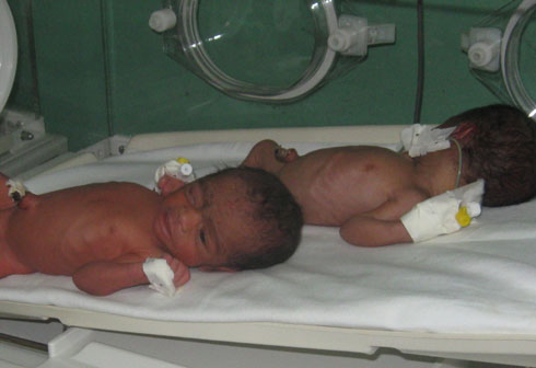 Abana baracyari mu cyuma gikomeza gutuma bamera neza.