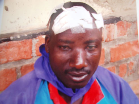 Afite ibikomere mu mutwe byaturutse ku mabuye bamuteye.