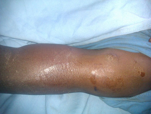 Aho yagiye akubitwa inkoni ku maboko ashinjwa kuba umusirikare w'u Rwanda.