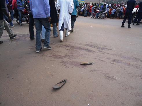 Aho impanuka yabereye, uwacitse amaguru yahasize inkweto.