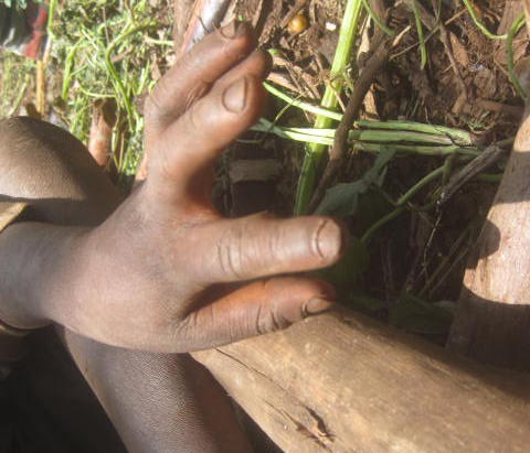 Amavunja amaze kugera ku ntoki.