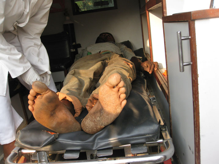 Camubanzi amaze kugezwa mu modoka itwara indembe ajyanywe ku bitaro bya Kigeme.