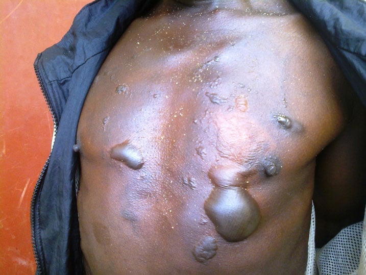 Habyarimana watwikishijwe amazi ashyushye n