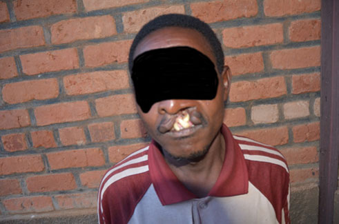 Uyu yabwiye Kigali Today ko yizeye ko azavurwa agakira