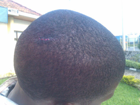 Ibikomere mu mutwe kubera gukubitwa n'abasirikare na polisi ba Congo.