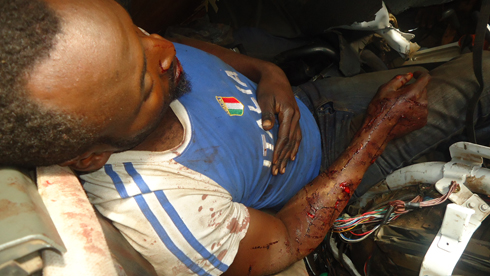 Shoferi yari yafashwe n'ibyuma yananiwe kuva mu modoka.