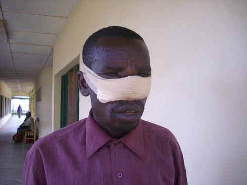 Kubwumukiza Yottamu wahohotewe akarumwa izuru rye.