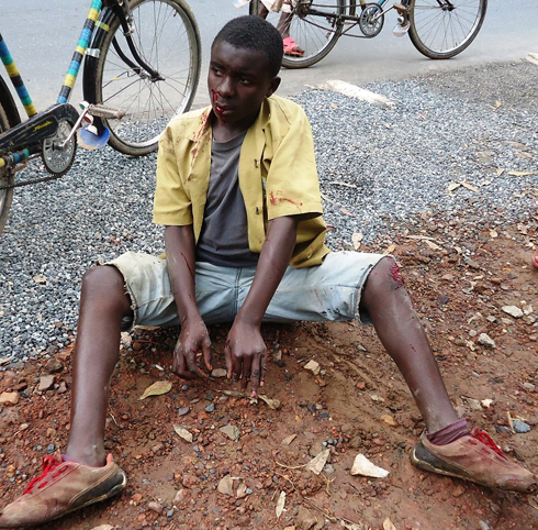 Maniraroran yakomeretse ku mavu, ku maboko no ku munwa. Yagiye kuvurirwa ku bitaro bikuru bya Nemba.