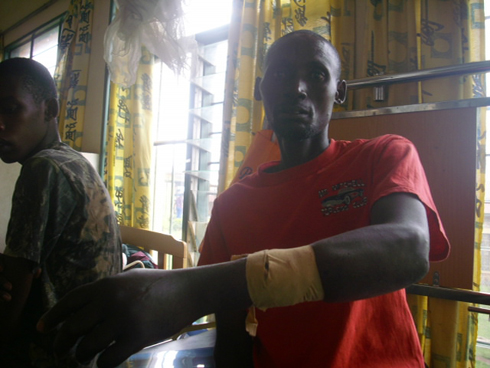 Ukuboko kwa Mbarubukeye JMV yatemwe na mukuru we igufa rigacikamo kabiri. Ubu arwariye mu bitaro bya Nyanza.