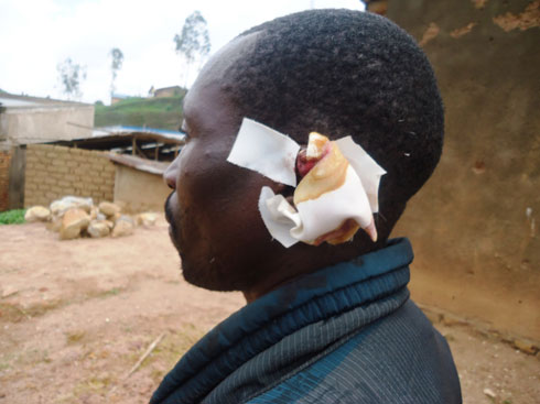 Mubirigi yagize amahirwe aho ubundi ugutwi kwari gucitse.