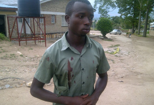 Murwanashyaka yaciriwe imyenda anakomeretswa umunwa.