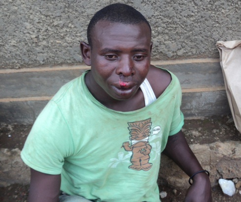 Yakomerekejwe ku munwa.