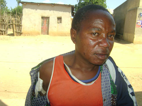 Ndimurwango Alphonse aho arwariye iwe mu rugo.