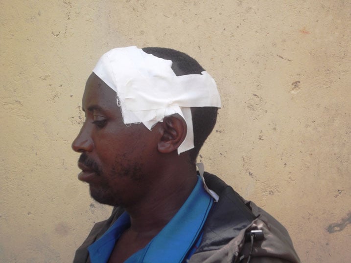 Ngo bari bamaze iminsi bamubwira ko bazamukubita none babigezeho.