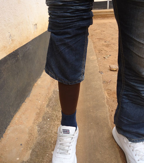 Insimburangingo bamuguriye imeze nk'akaguru gasanzwe kuburyo utamenya ko afite ubumuga.