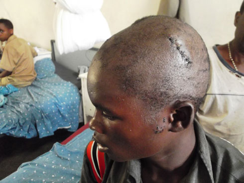 Ntabwo azi abamukomerekeje icyakora ababonye ngo yabamenya.