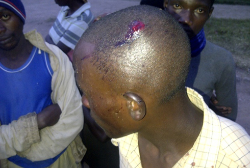 Ntirugiribambe yakomerekeje umukuru w'umudugudu wa Nyabinyenga abwo bashakaga kumuta muri yombi.