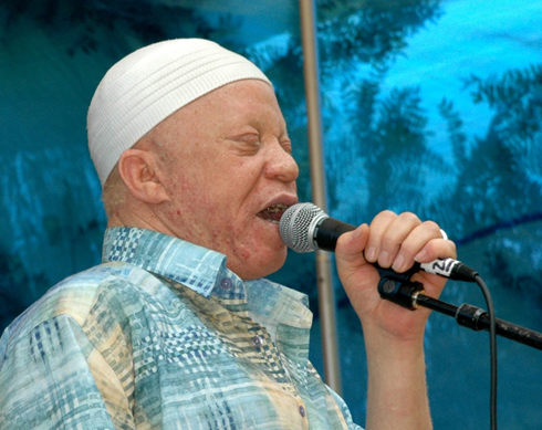 Nubwo ari nyamweru, Salif Keita ntibyamubujije kuba icyamamare muri muzika.