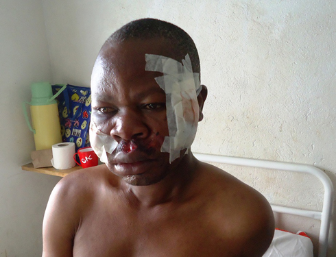 Turahimana mu bitaro bikuru bya Nemba.