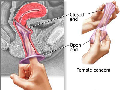 Uko agakingirizo k'abagore kagaragara iyo kakuwe mu gapaki.