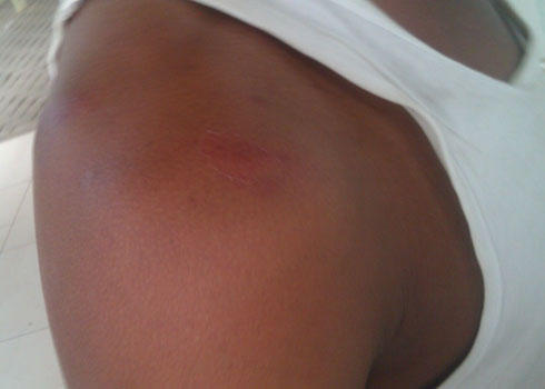 Uwimana ngo yaharatuwe ku ntugu kugira ngo bagaragaze ko aheka imbunda.