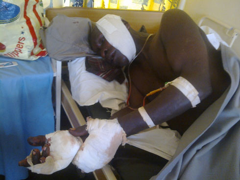 Umusaza Katabirora Faustin yatemwe n'umuhungu we anamukuramo amenyo atanu. Ubu arwariye mu bitaro by'akarere ka Nyanza.