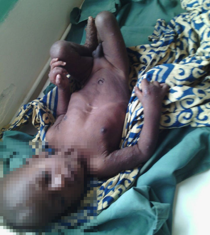 Kuba uyu mwana bigaragara ko yazahajwe n'imirire mibi nicyo gituma bacyeka ko ari Umurundi.