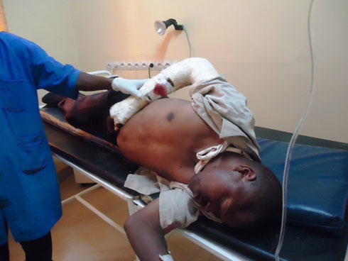 Umwe mu bagonzwe yabyimbye inda anakomereka mu maso.