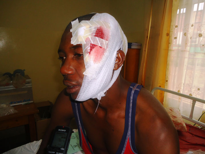 Uyu mugabo wakomeretse cyane avuga ko yazahaye kuko umutwe we wamenaguritse.