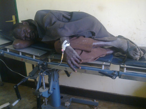 Uyu musaza yari yabyimbye mu maso kubera inzuki zamuriye.