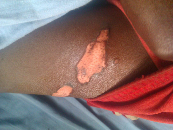 Uyu yatwikishijwe umuriro amanikwa mu giti azira kuba Umunyarwanda.