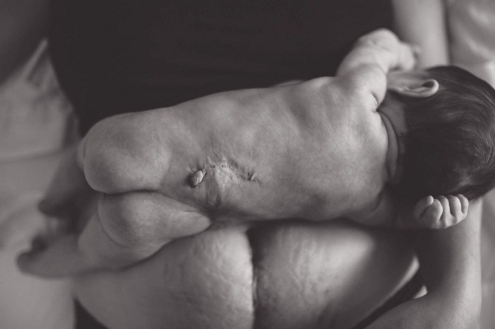 Abaganga bemeza ko iyi ndwara atari amarozi