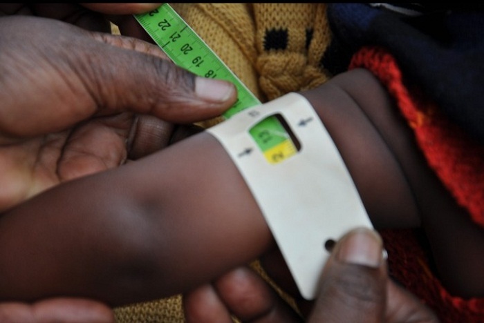 Bifuza ko bakongererwa ibikoresho byo gupima imikurire y