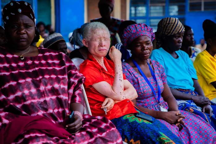 Abafite ubumuga barasaba ko bagira komite guhera ku rwego rw