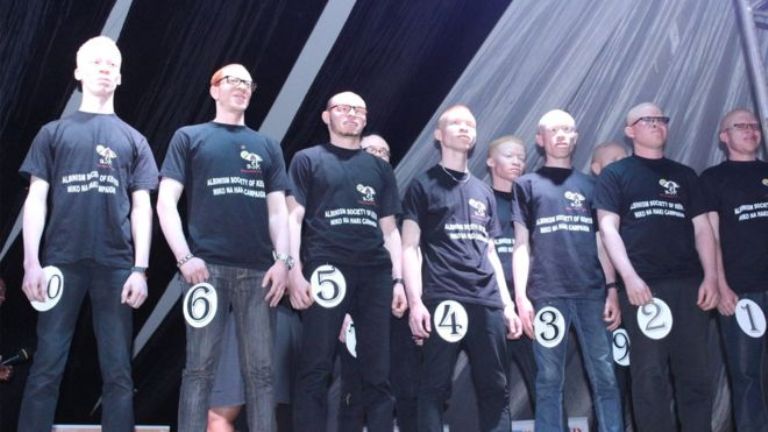 Abasore bahataniraga ikamba rya Rudasumbwa w'abafite ubumuga bw'uruhu