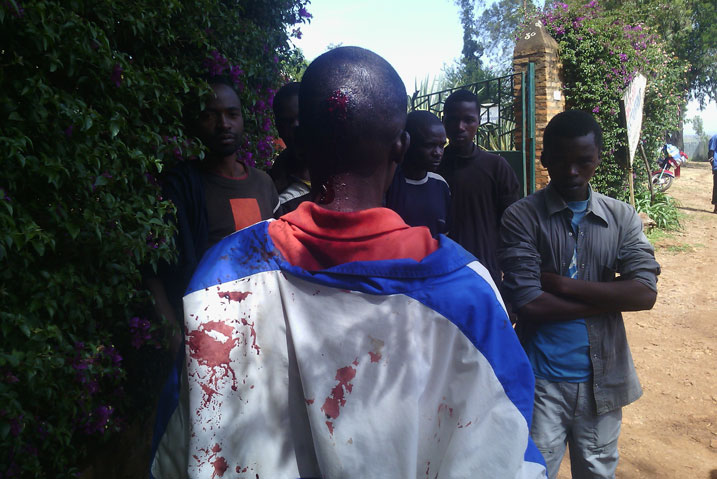 Kayumba yakomerekejwe mu mutwe na Remy amusekuje ku gikuta.