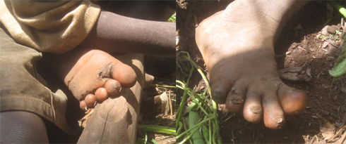 Ngo bamuhandura buri gitondo ariko amavunja yanze kumushiraho.