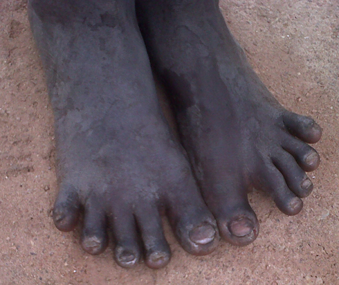 Ibirenge bya Kanyenzira byuzuye amavunja.