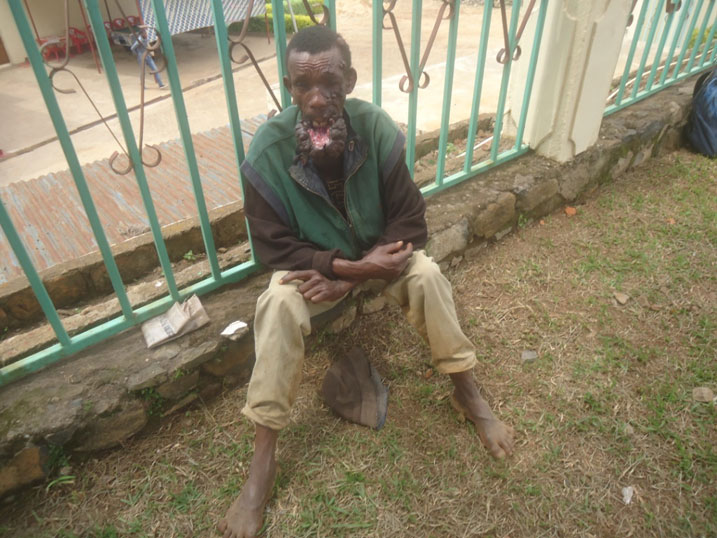 Amaze imyaka 37 afite ubwo burwayi.