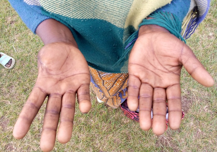 Yaciwe urutoki biturutse ku biyobyabwenge