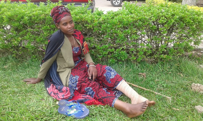 Bazirete Chantal arasaba ubufasha nyuma yo kuvunika ahunga igitera