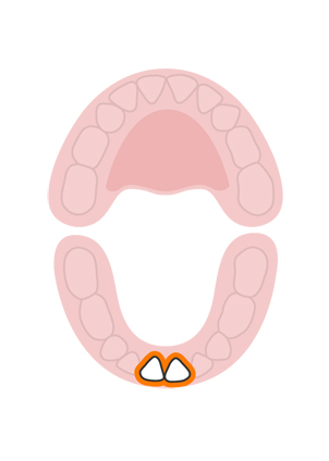 Icyiciro cya 1: abiri yo hasi