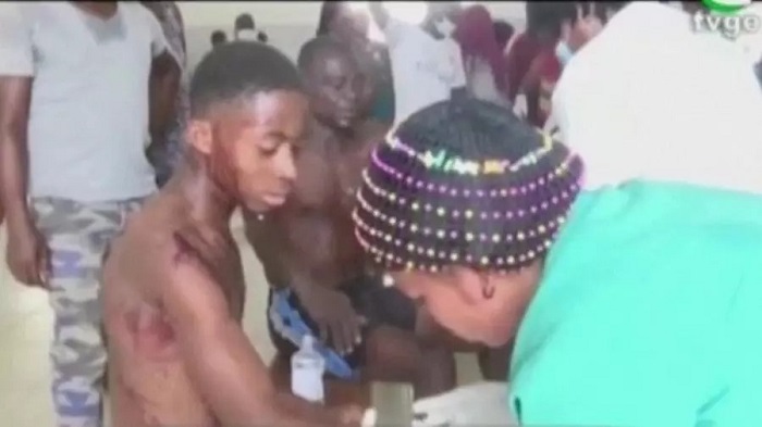 Abakomeretse barimo kwitabwaho