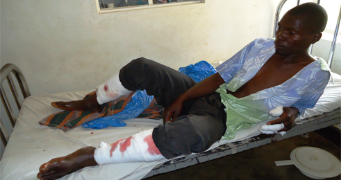 Kuradusenge yakomerekanye n